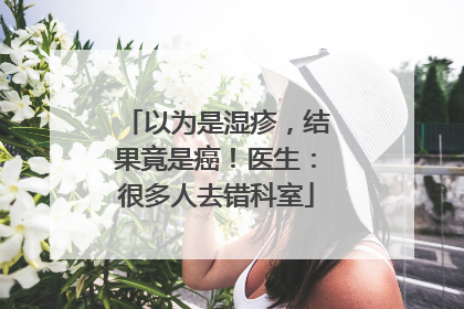 以为是湿疹，结果竟是癌！医生：很多人去错科室